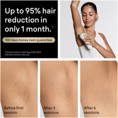 Braun Silk·expert Pro 5 IPL: Alternative to Laser Hair Removal with 4 Caps and Vanity Case, PL5347